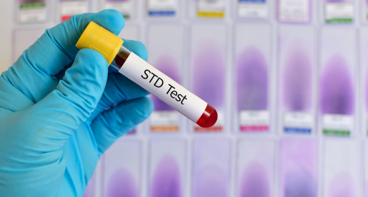 book lab tests at home in Dubai