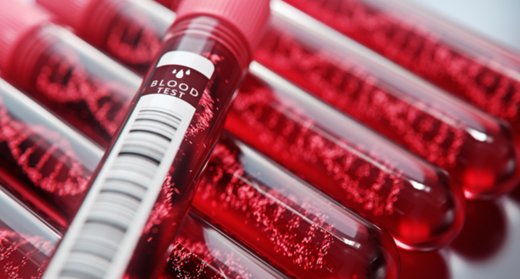 Book a blood test at home in Sharjah